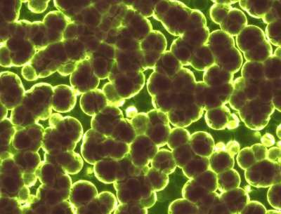 细菌 微生物 医疗的 微观的 科学 生物学 感染 Blob 生物