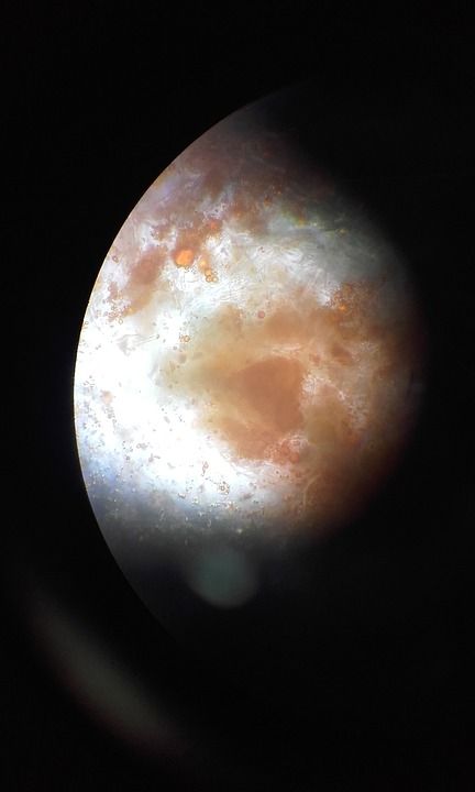 生物学 显微镜 萝卜 黑色的 橙色的 圆形 月亮 红色 景点