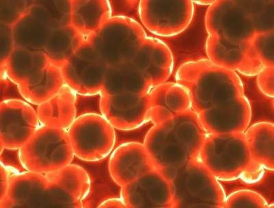 细菌 微生物 医疗的 微观的 科学 生物学 感染 Blob 生物