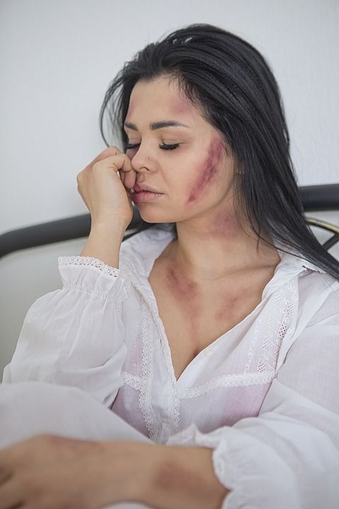 女士 挫伤 虐待 暴力 家庭暴力 骚扰 伤害 疼痛 肖像