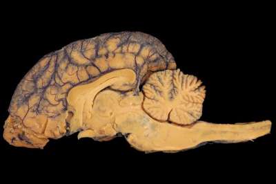 脑 解剖学 狗 Paerparat 马 生物学 背 身体 兽医